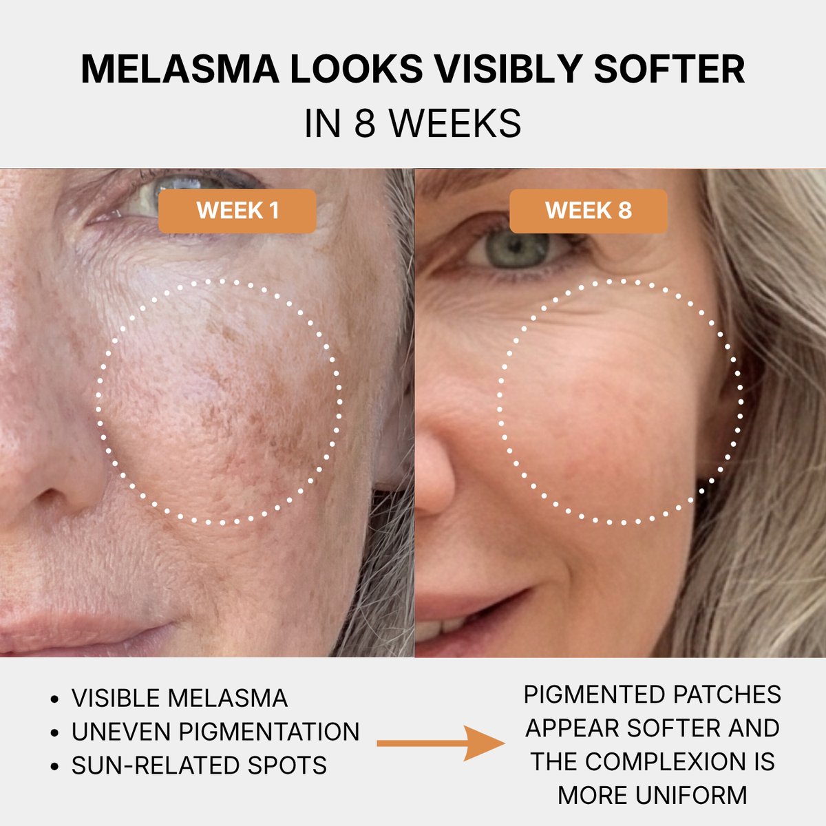Anti-Dark Spots Turmeric Routine