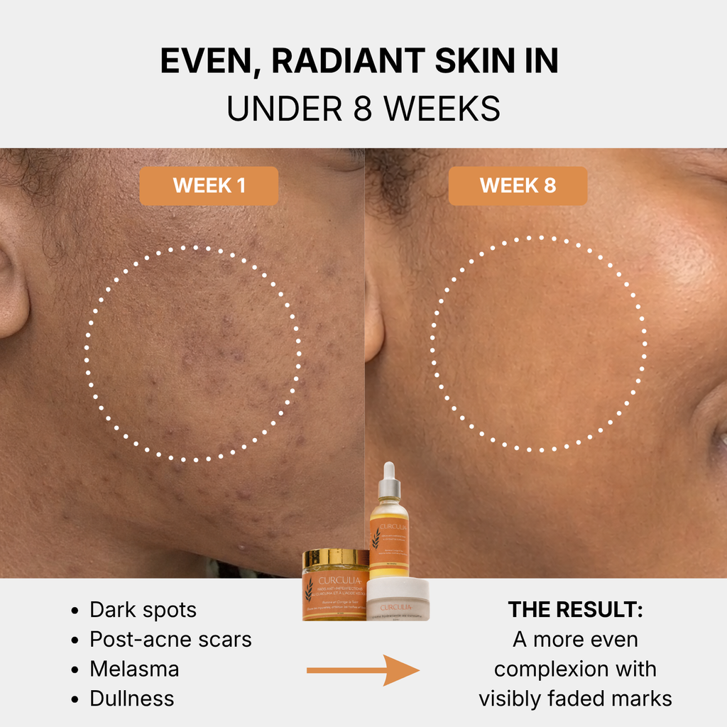 French Formulated Anti-Dark Spots Turmeric Routine