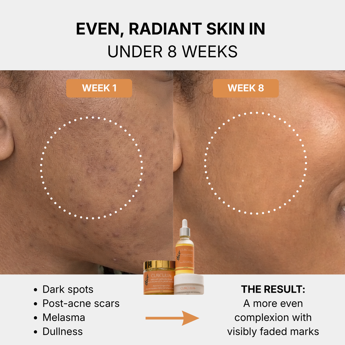 French Formulated Anti-Dark Spots Turmeric Routine
