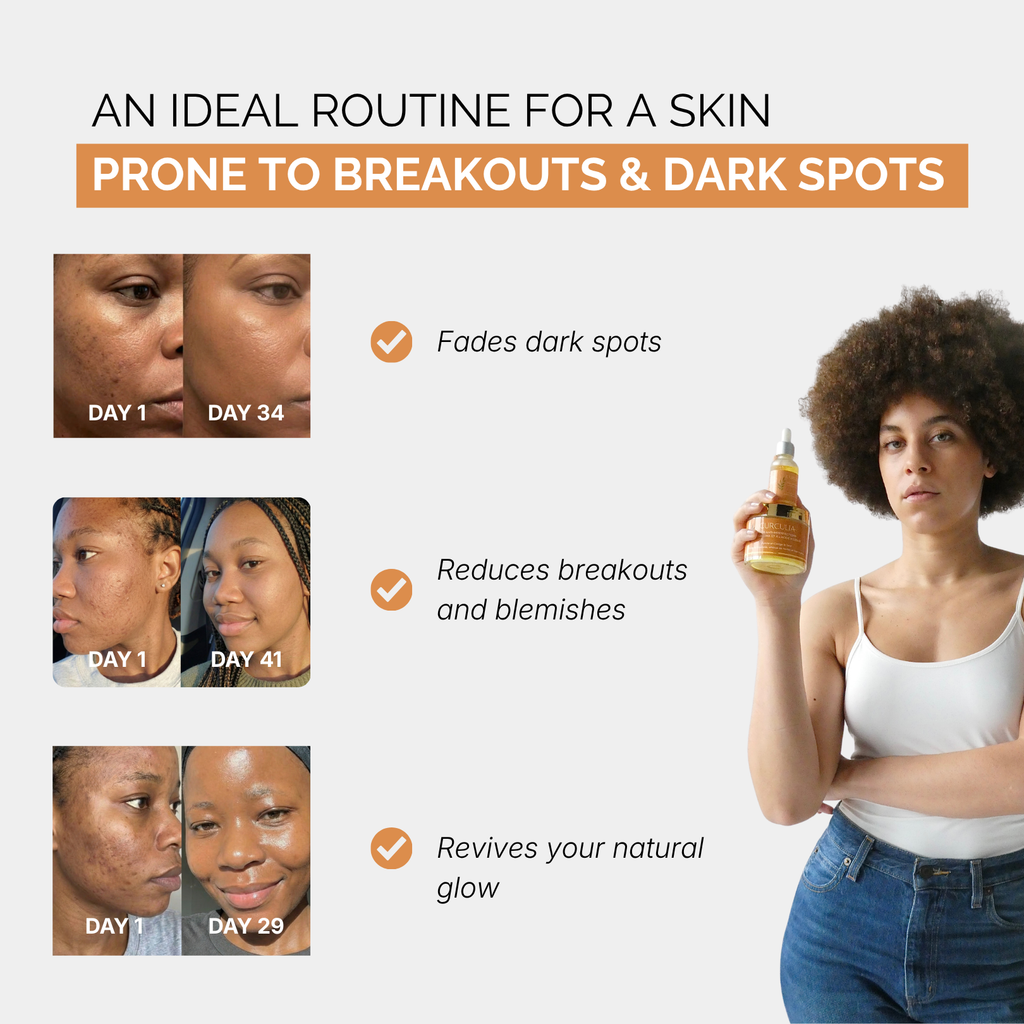 French Formulated Anti-Dark Spots Turmeric Routine