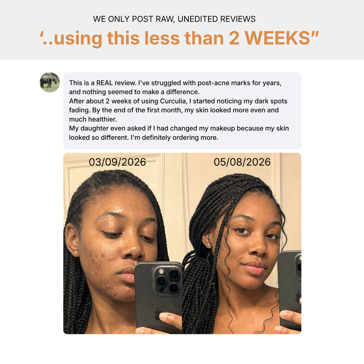 French Formulated Anti-Dark Spots Turmeric Routine