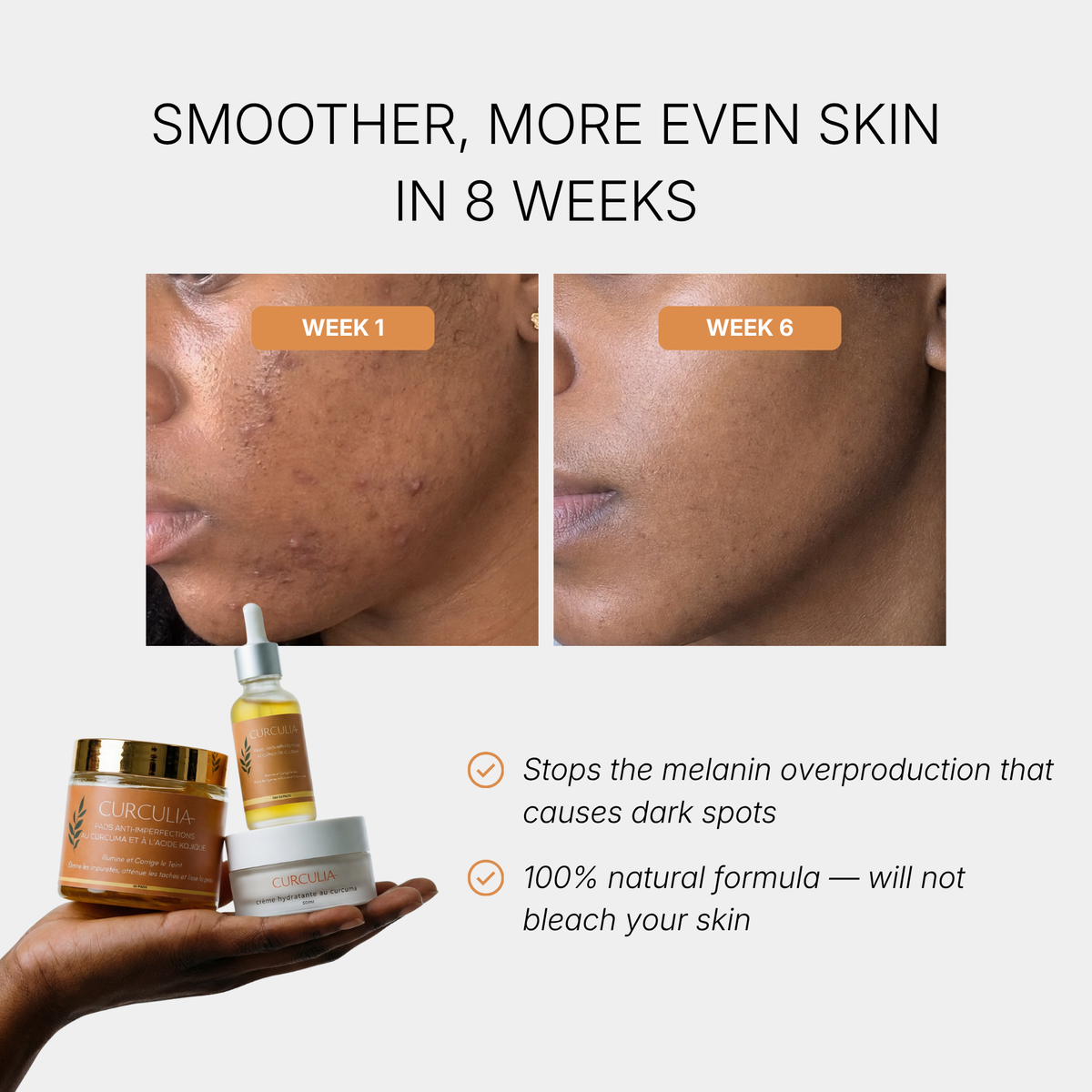 French Formulated Anti-Dark Spots Turmeric Routine
