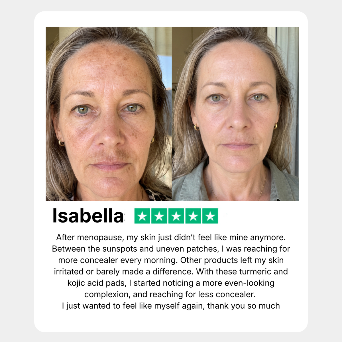 Anti-Dark Spots Turmeric Routine