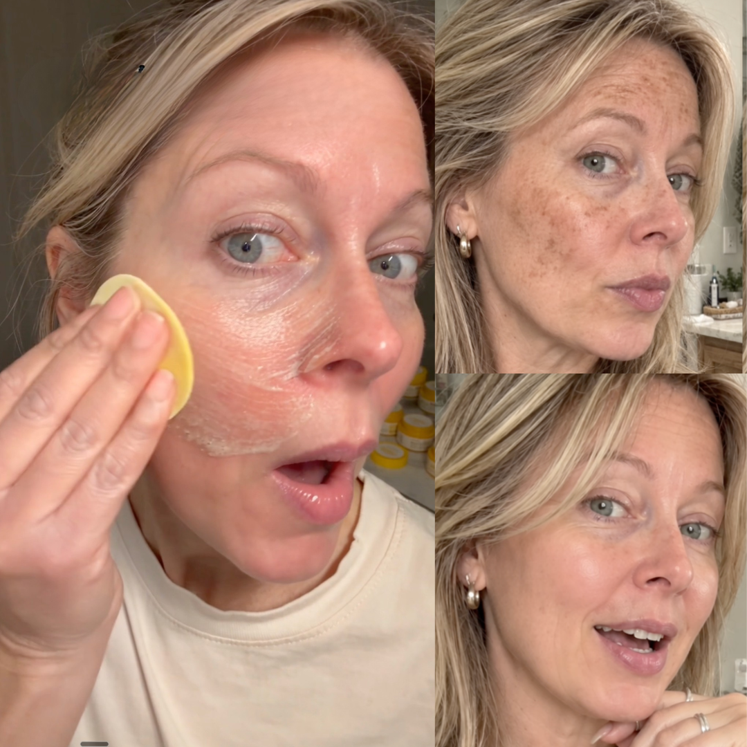 This Doctor-Approved Turmeric Ritual Could Be The Easiest Way to Fade your Stubborn Dark Spots After 45